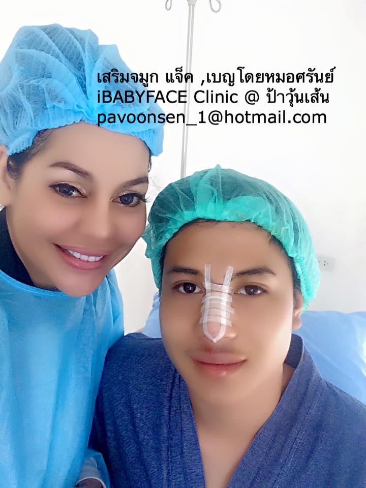 ป้าวุ้นเส้นพา แจ็ค ไปเสริมจมูกมาแบบผู้ชาย หล่อคม