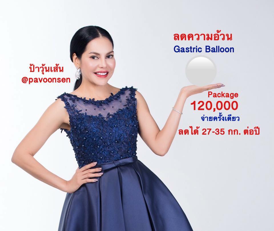 ลดความอ้วนปลอดภัยได้ผล 27 – 35 กิโลกรัมต่อปี ใส่บอลลูนกระเพาะอาหาร